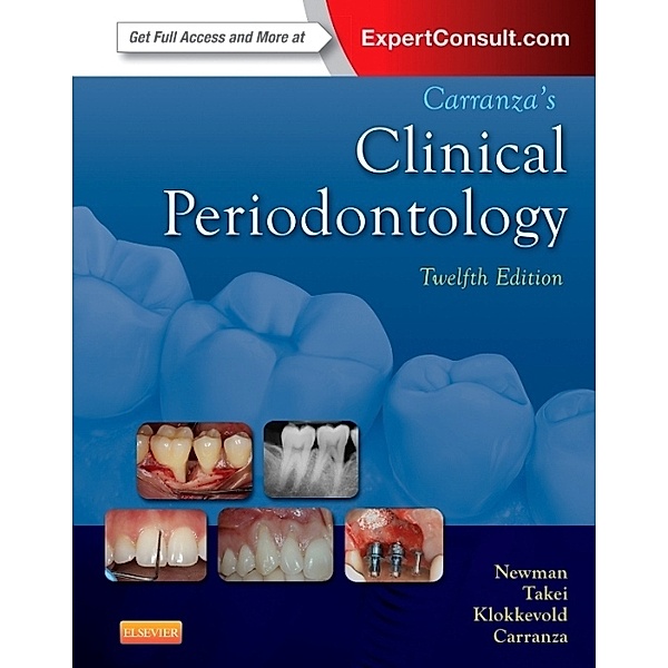 Carranza's Clinical Periodontology, Michael G. Newman, Henry Takei, Perry R. Klokkevold, Fermin A. Carranza
