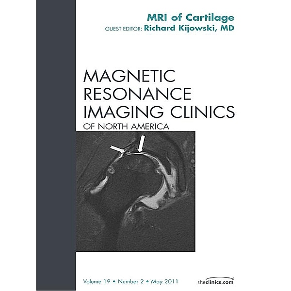 Cartilage Imaging, An Issue of Magnetic Resonance Imaging Clinics, Richard Kijowski