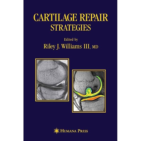 Cartilage Repair Strategies