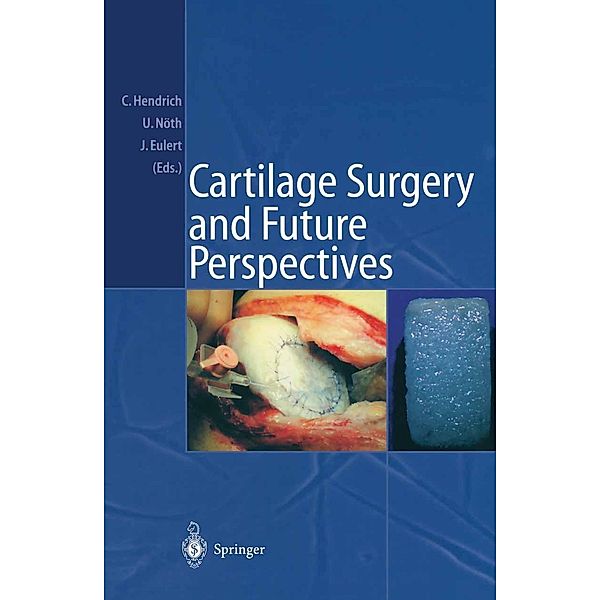 Cartilage Surgery and Future Perspectives