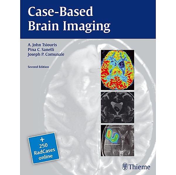 Case-Based Brain Imaging, A. John Tsiouris, Joseph Communale, Pina Sanelli