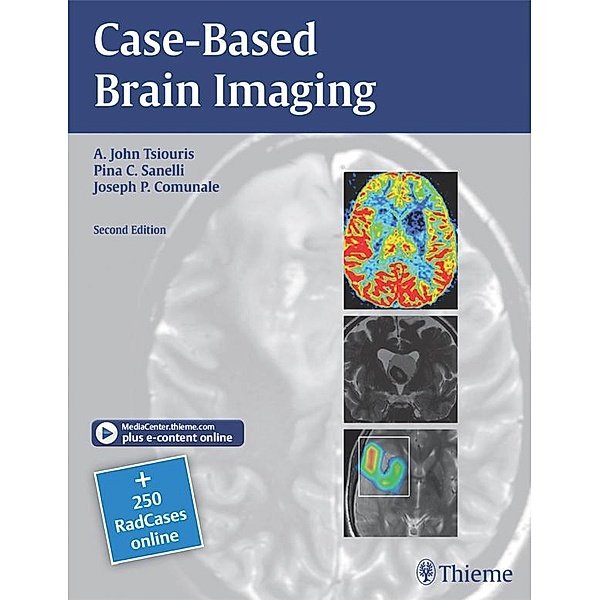 Case-Based Brain Imaging, A. John Tsiouris, Pina C. Sanelli, Joseph Comunale