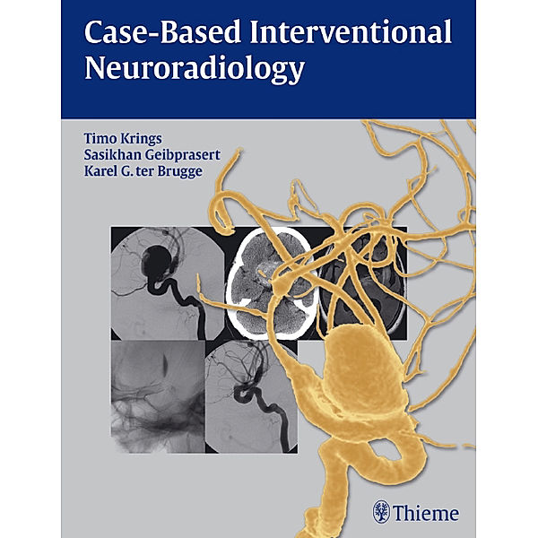 Case-Based Interventional Neuroradiology, Timo Krings, Sasikhan Geibprasert, Karel ter Brugge
