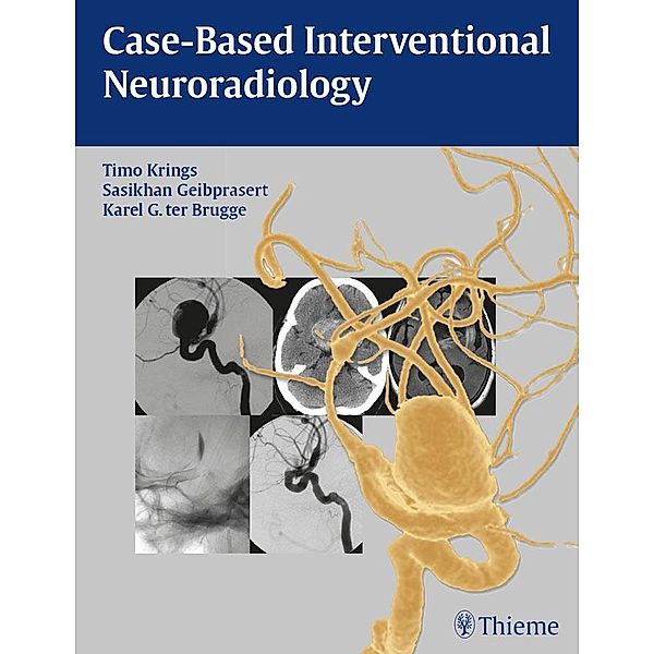 Case-Based Interventional Neuroradiology, Timo Krings, Sasikhan Geibprasert, Karel G. ter Brugge