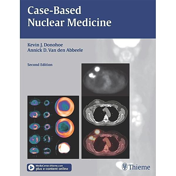 Case-Based Nuclear Medicine