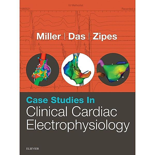 Case Studies in Clinical Cardiac Electrophysiology E-Book, John M. Miller, Mithilesh K. Das, Douglas P. Zipes