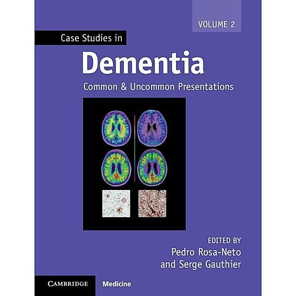 Case Studies in Dementia: Volume 2 / Case Studies in Neurology