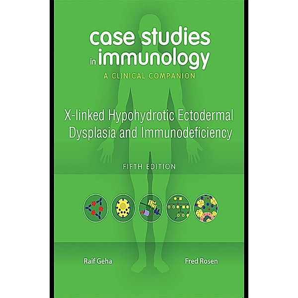 Case Studies in Immunology: X-linked Hypohydrotic Ectodermal Dysplasia and Immunodeficiency, Raif Geha, Fred Rosen