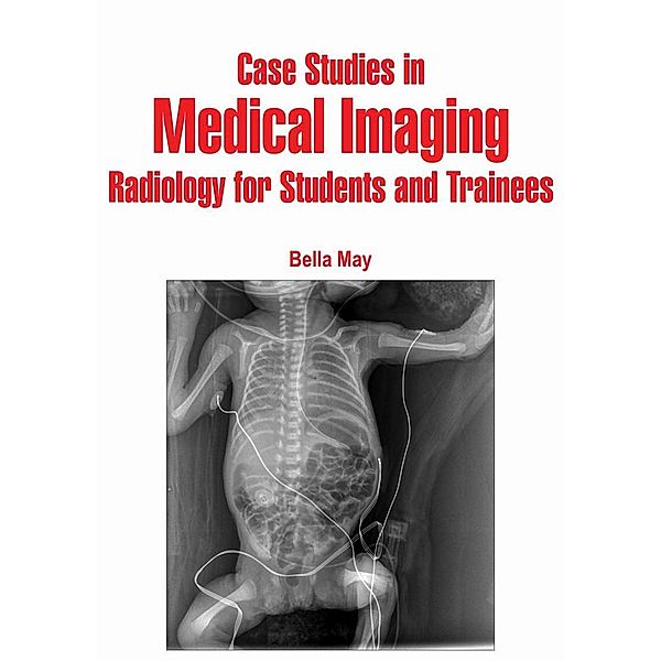 Case Studies in Medical Imaging, Bella May