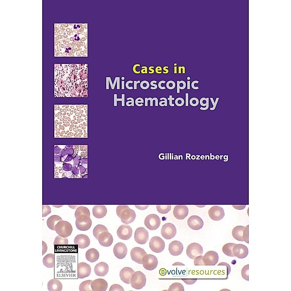 Cases in Microscopic Haematology - E-Book, Gillian Rozenberg