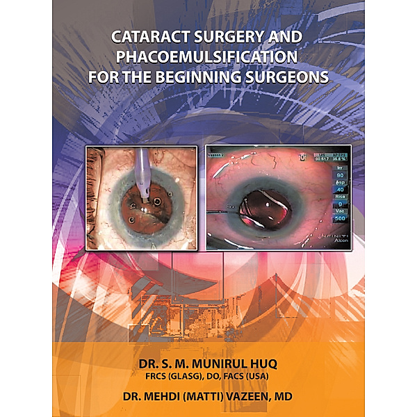 Cataract Surgery and Phacoemulsification for the Beginning   Surgeons, Dr.Mehdi Vazeen MD, Dr.S.M.Munirul Huq