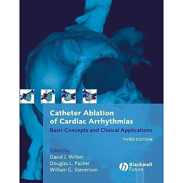 Catheter Ablation of Cardiac Arrhythmias