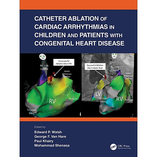 Catheter Ablation of Cardiac Arrhythmias in Children and Patients with Congenital Heart Disease