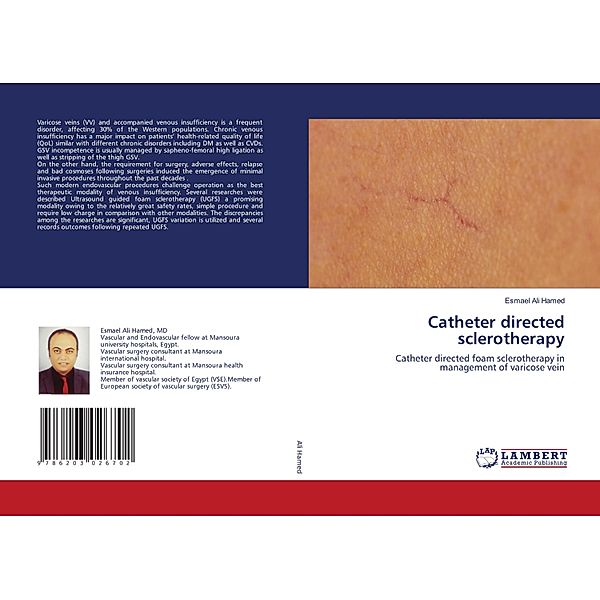 Catheter directed sclerotherapy, Esmael Ali Hamed