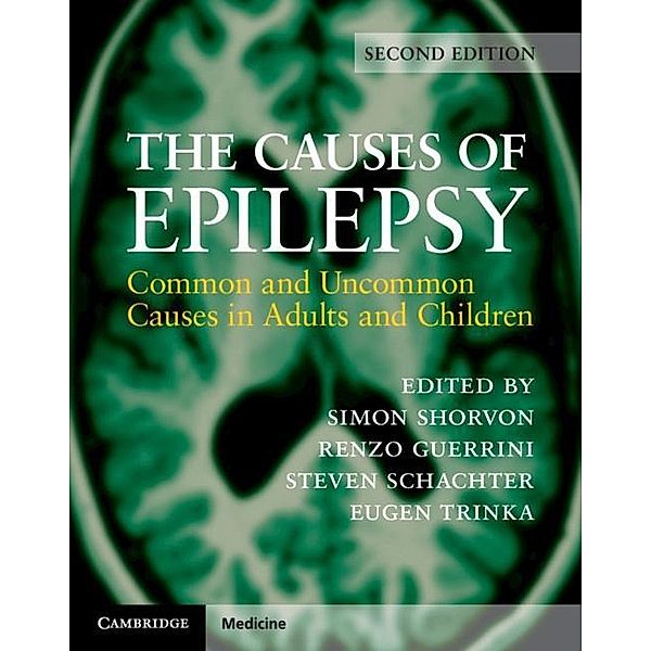 Causes of Epilepsy