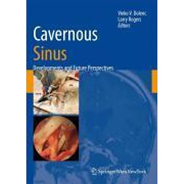 Cavernous Sinus
