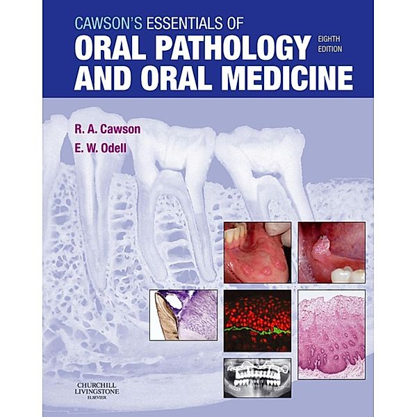 Cawson's Essentials of Oral Pathology and Oral Medicine E-Book, Roderick A. Cawson, Edward W Odell