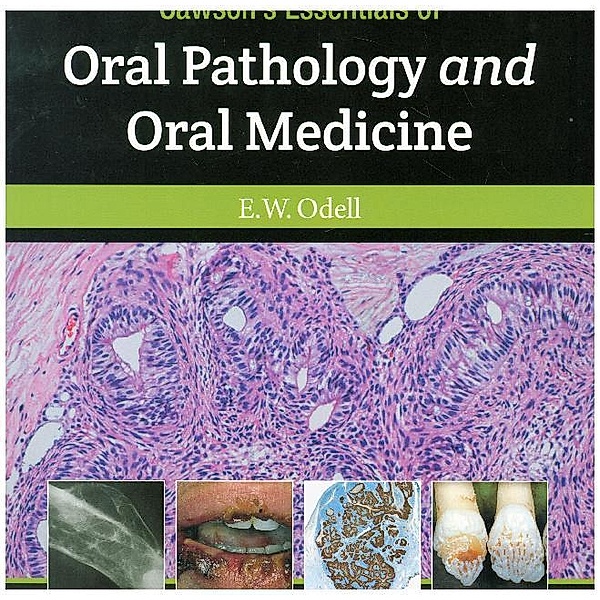 Cawson's Essentials of Oral Pathology and Oral Medicine, Edward W. Odell