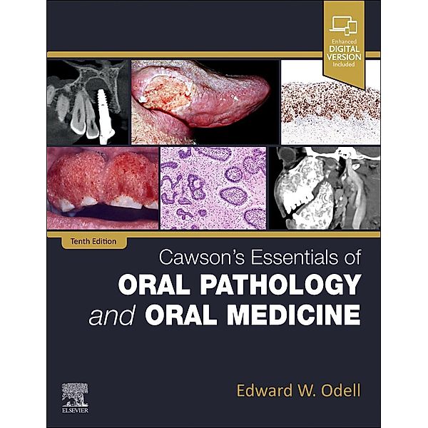 Cawson's Essentials of Oral Pathology and Oral Medicine, Edward W Odell