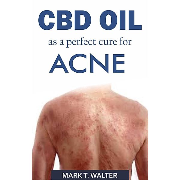 CBD Oil as a Perfect Cure for Acne, Mark T. Walter