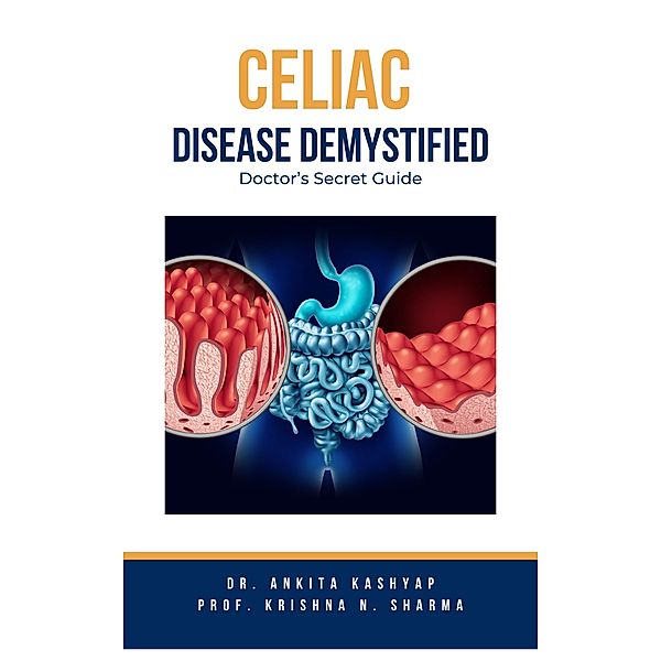 Celiac Disease Demystified: Doctor's Secret Guide, Ankita Kashyap, Krishna N. Sharma