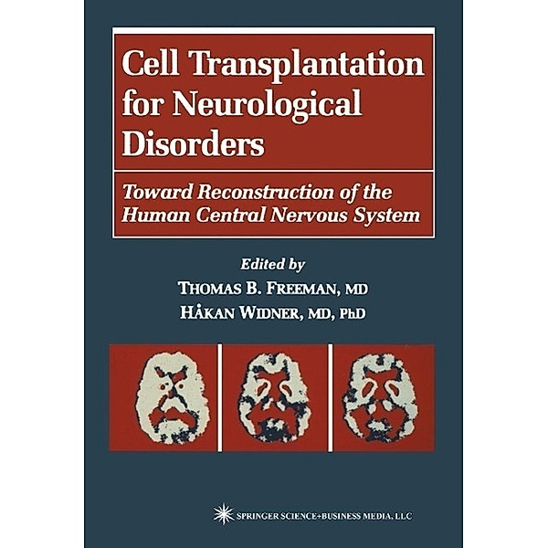 Cell Transplantation for Neurological Disorders / Contemporary Neuroscience