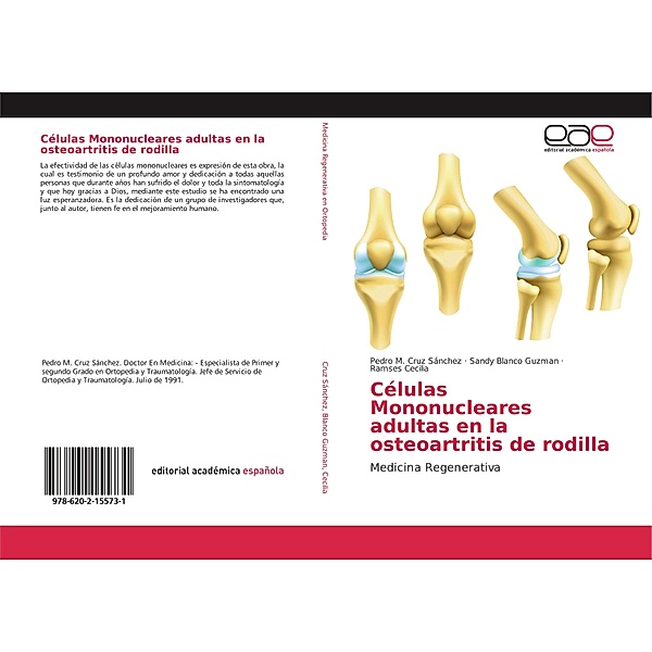 Células Mononucleares adultas en la osteoartritis de rodilla, Pedro M. Cruz Sánchez, Sandy Blanco Guzman, Ramses Cecilia