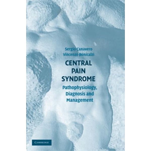 Central Pain Syndrome, Sergio Canavero