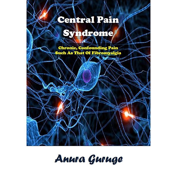 Central Pain Syndrome, Anura Guruge