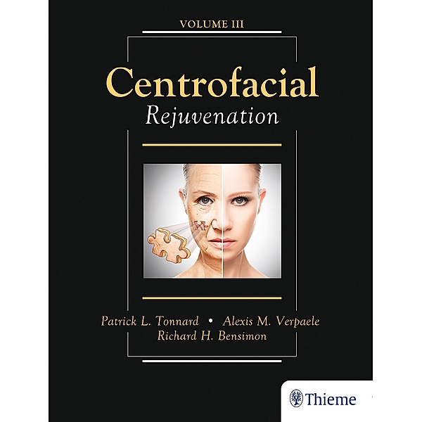 Centrofacial Rejuvenation, Patrick Tonnard, Alexis Verpaele, Richard Bensimon