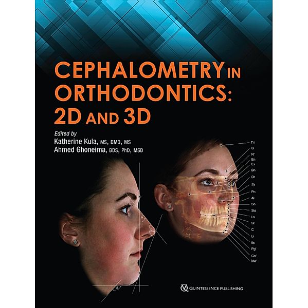 Cephalometry in Orthodontics, Katherine Kula, Ahmed Ghoneima