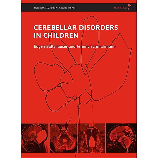 Cerebellar Disorders in Children / 191, Eugen Boltshauser, Jeremy Schmahmann