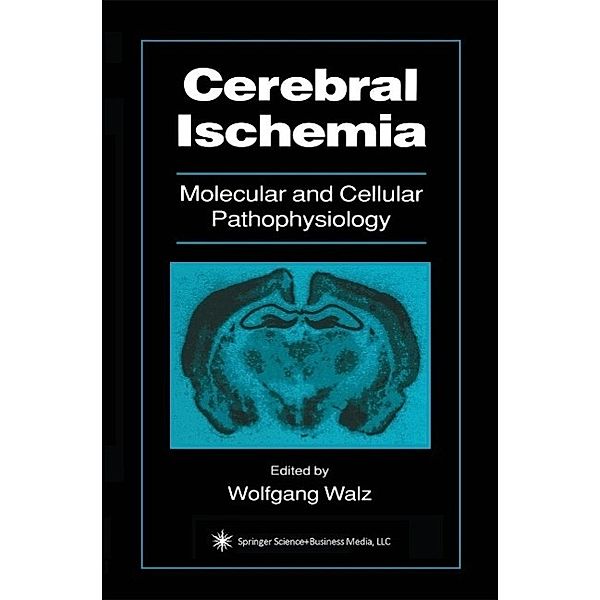 Cerebral Ischemia / Contemporary Neuroscience