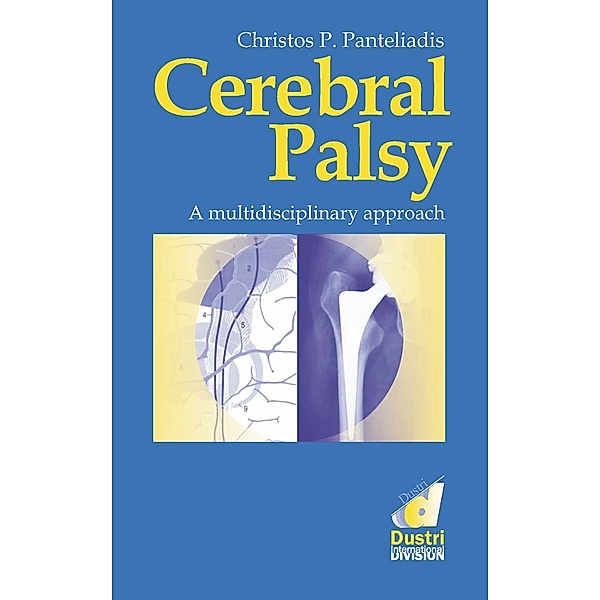 Cerebral Palsy., Christos P. Panteliadis