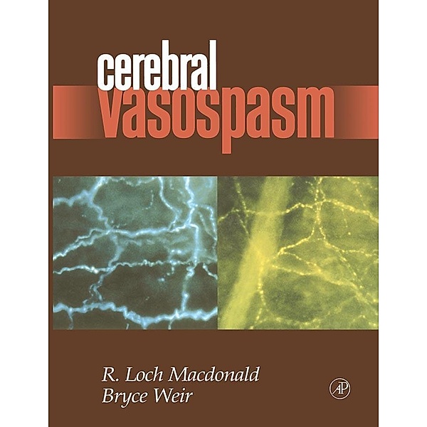 Cerebral Vasospasm, R. Loch Macdonald, Bruce Weir