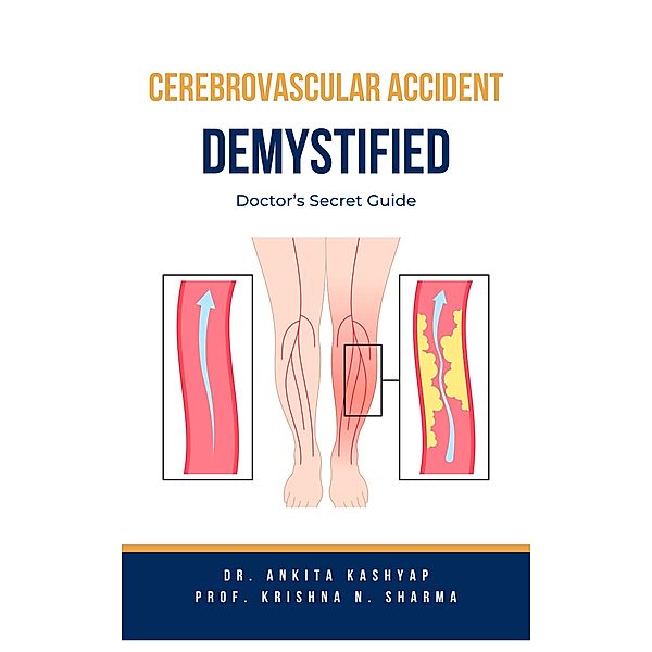 Cerebrovascular Accident Demystified: Doctor's Secret Guide, Ankita Kashyap, Krishna N. Sharma