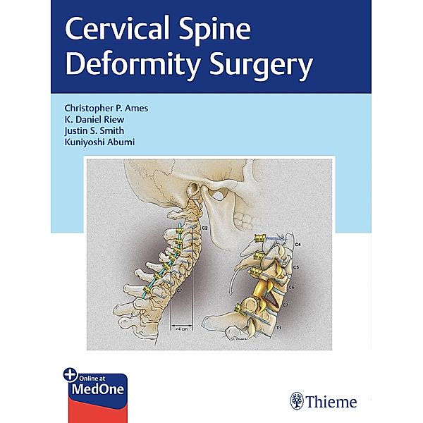 Cervical Spine Deformity Surgery, Christopher P. Ames, K. Daniel Riew, Justin S. Smith, Kuniyoshi Abumi