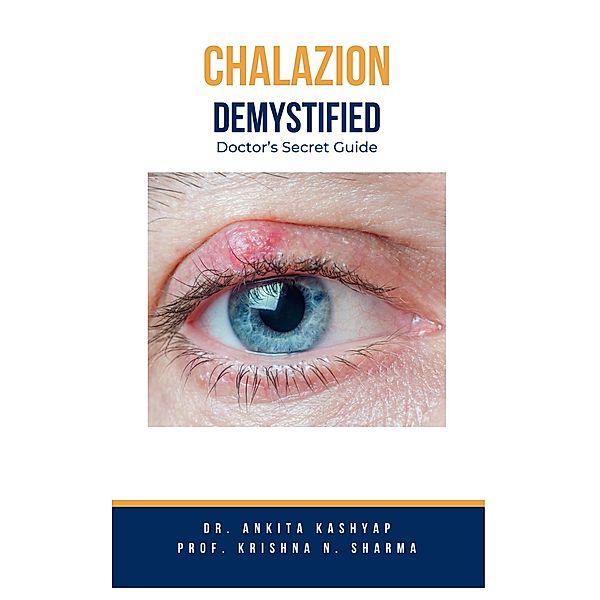 Chalazion Demystified: Doctor's Secret Guide, Ankita Kashyap, Krishna N. Sharma