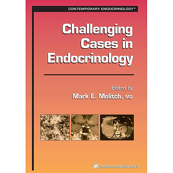 Challenging Cases in Endocrinology