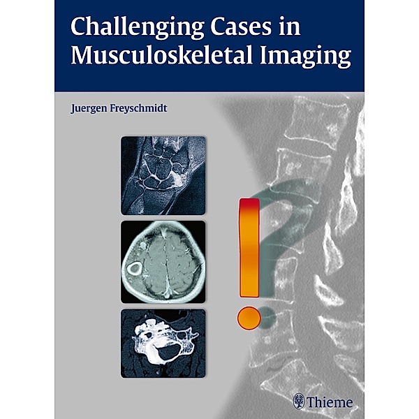 Challenging Cases in Musculoskeletal Imaging, Jürgen Freyschmidt