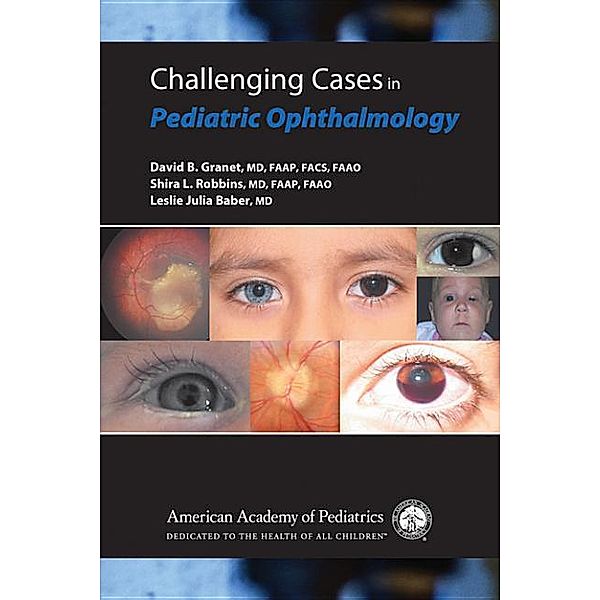 Challenging Cases in Pediatric Ophthalmology, American Academy of Pediatrics