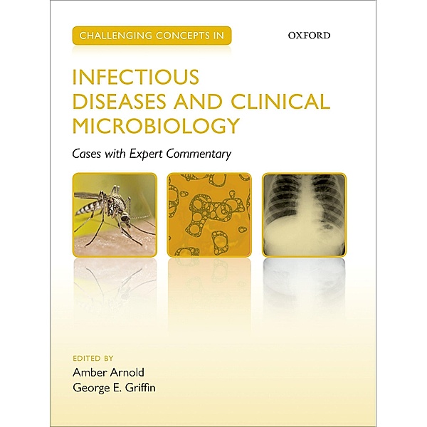 Challenging Concepts in Infectious Diseases and Clinical Microbiology / Challenging Concepts