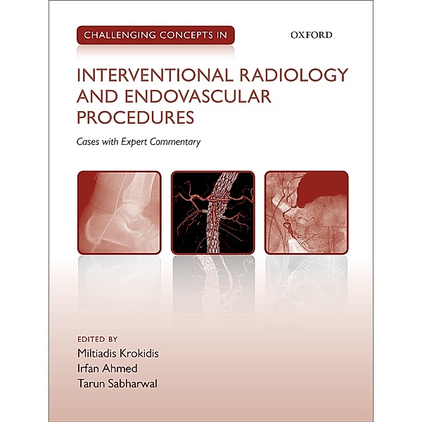 Challenging Concepts in Interventional Radiology / Challenging Concepts