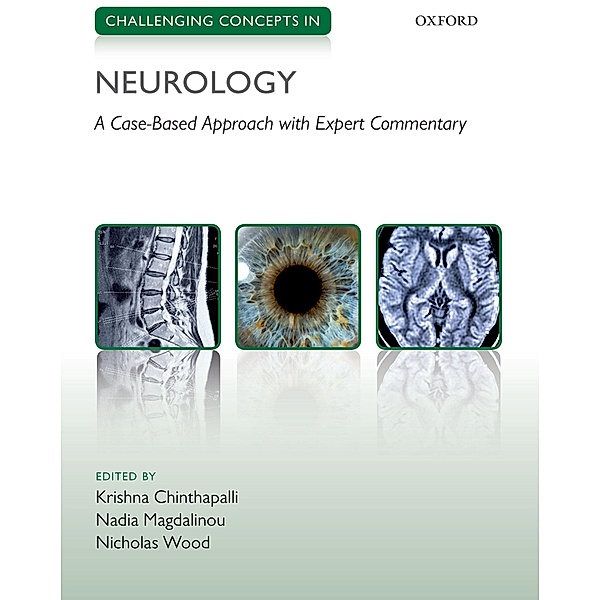 Challenging Concepts in Neurology / Challenging Concepts