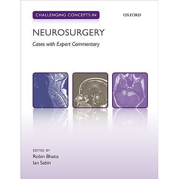 Challenging Concepts in Neurosurgery