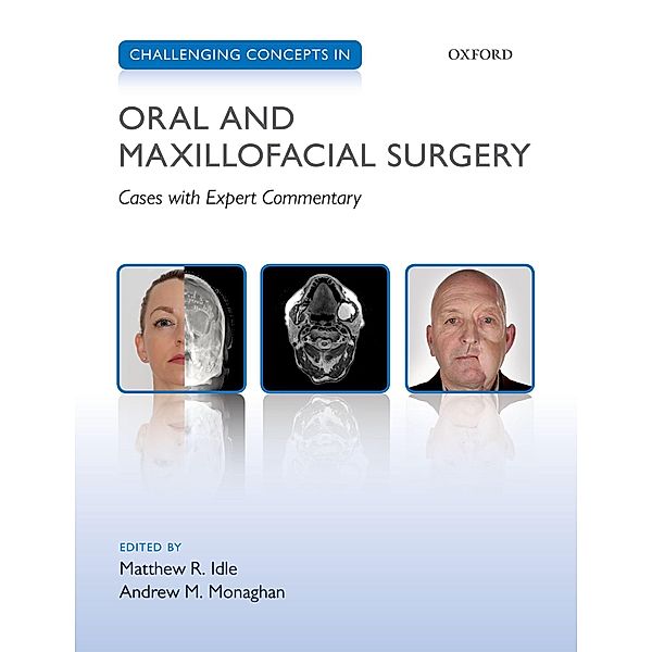 Challenging Concepts in Oral and Maxillofacial Surgery / Challenging Concepts