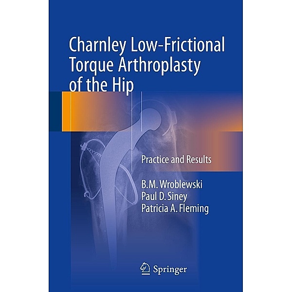 Charnley Low-Frictional Torque Arthroplasty of the Hip, B. M. Wroblewski, Paul D. Siney, Patricia A. Fleming
