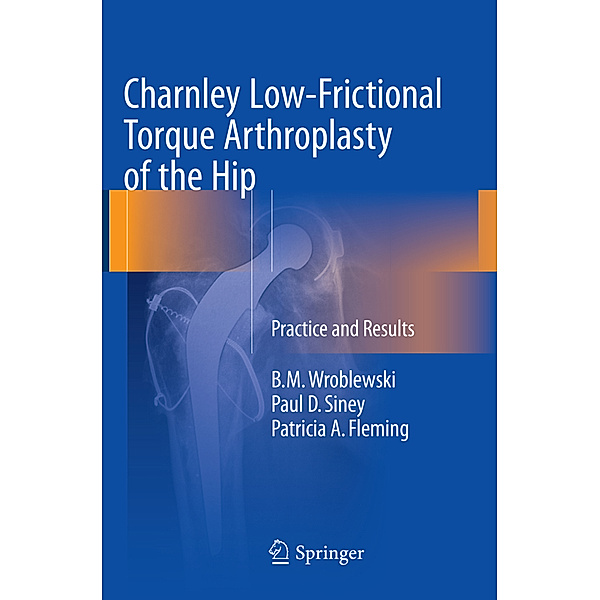 Charnley Low-Frictional Torque Arthroplasty of the Hip, B.M. Wroblewski, Paul D. Siney, Patricia A. Fleming