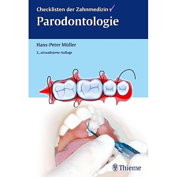 Checklisten der Zahnmedizin Parodontologie / Checklisten Zahnmedizin, Hans-Peter Müller