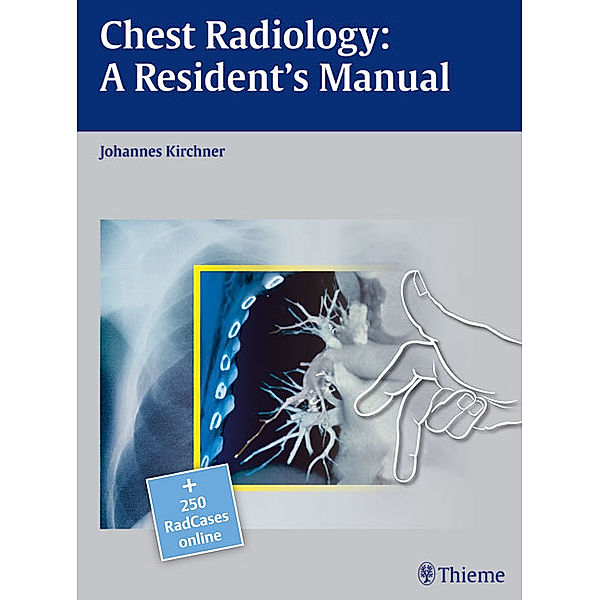 Chest Radiology, Johannes Kirchner